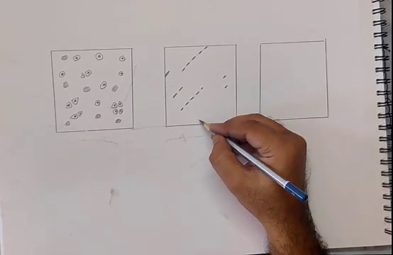 How to Draw Types of Cartilage | Hyaline, Elastic & Fibrocartilage Diagram