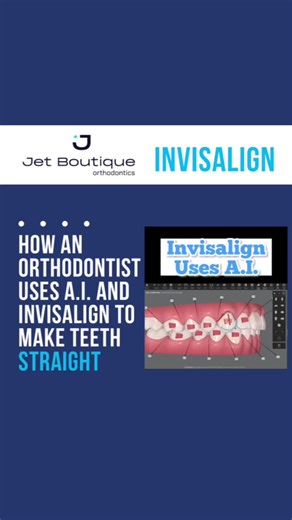 How Invisalign uses artificial intelligence. It’s been amazing to use Invisalign’s Clincheck artificial intelligence software for almost a decade and be a part of the rapid improvements of their technology. An orthodontist’s knowledge of smile design, bite alignment and facial structure development, combined with Invisalign’s sophisticated software, make for a powerful combination to help treat people just like you. #orthodontist #orthodontics #orthodontistsoftiktok #invisalign #invisalignprovid