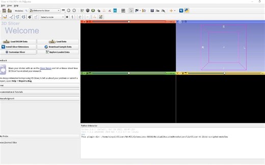 【3D Slicer】自制2D血管（DSA）分割插件！大幅提升科研效率！