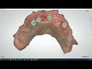 DentalTechTutorial - How to use 3shape's Implant Waxup Bridge Workflow For Converting Your Waxup