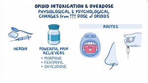 Video: Opioid intoxication and overdose: Clinical sciences - Video Explanation! | Osmosis | Osmosis