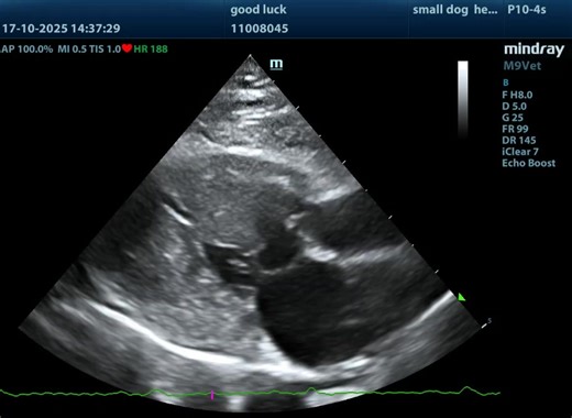 2.1K views | 右側長軸四腔室(Right parasternal long axis four-chamber view) | 朱道南 | Facebook