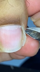 All about trimming cuticle #fypシviralシ2024 #fypviralシ #fypシ゚viral #satisfied #viralchallenge #relief #pedicure #relaxing @topfans | Ingrown Queen Vlogs