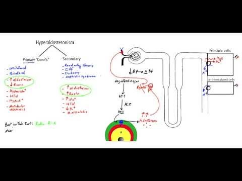 Conn's syndrome (Primary Hyperaldosteronism) - MADE EASY