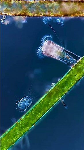 Microorganisms or microbes? #microscope #microorganisms