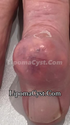 Dr Khaled Sadek on Instagram: "Can you guess?"