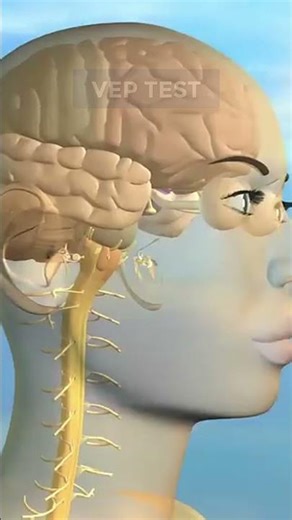 Neuropack X1 Installation | Nihon Kohden EMG & EP Machine in Swat