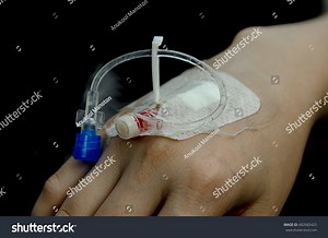 Patient Hand Had Injection Plug Injecting Stock Photo 682682425 | Shutterstock