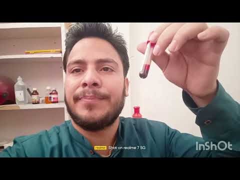 Lft Test Report Full review parm medicine ### vlogg,,,