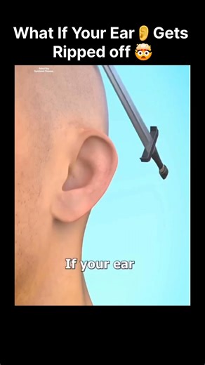 What If Your Ear👂Gets Ripped off 🤔 | When your ear gets cut off # #earripped #ytshorts