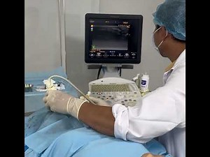 Auriculotemporal Nerve + Supraobital Nerve Block for cluster headache
