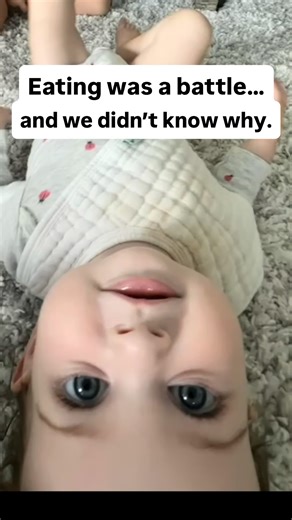 Raising Remi on O₂ | Medically Complex Parents on Instagram: "She refused feed after feed… and no one could explain why. We didn’t understand it then — but this was the beginning of our search for answers. If your gut has ever told you something was wrong, you’re not alone. Follow Remi’s journey. 🌈 #medicalparent #feedingaversion #gtubebaby"