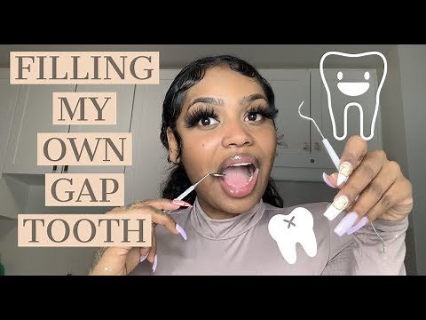 DIY DENTIST | CLOSED THE GAP IN MY TEETH MYSELF | BEAUTY BY PRIMA