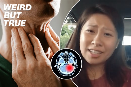 What is ‘foreign accent syndrome’? 9 shocking cases | Weird But True