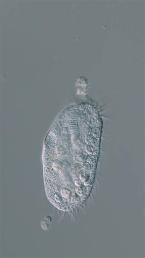 The microcosmos is fun. Ciliate working on its juggling act.