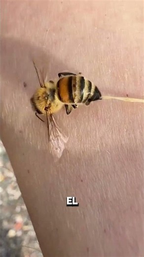 ¡Qué hacer si te pica una abeja! 🐝⚠️