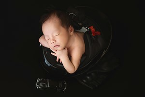 Do Insurance Policies Cover Baby Helmet Therapy Costs?