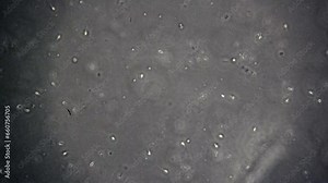 Slow zoom-in on microscopic human sperm cells swimming in seminal fluid. A dead sperm cell with a clearly visible tail is seen.