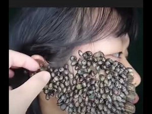 환공포증 유발 영상