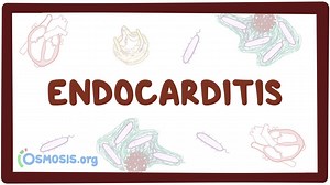 Endocarditis: Video, Causes, & Meaning | Osmosis
