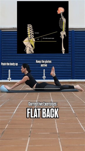 Flat back is a postural condition where the natural curve of the lower spine becomes reduced, causing the torso to lean forward and making it difficult to stand upright with ease. This loss of lumbar lordosis affects the body’s balance and often leads to stiffness, fatigue, and lower back or hip discomfort. Correcting flat back involves improving core activation, restoring mobility in the lumbar and thoracic spine, and strengthening the posterior chain - especially the glutes and erector spinae.