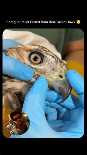 Red Dragon on Instagram: "The video you uploaded shows an injured Red-Tailed Hawk having a shotgun pellet removed from its beak/face area by veterinary staff. Incident: The hawk was shot, likely with a pellet gun or shotgun, resulting in an injury that required surgery and intensive care from a wildlife rescue team. Rehabilitation: These birds often need extensive physical therapy and recovery time before they can be released back into the wild. Unfortunately, injuries from projectiles are not u