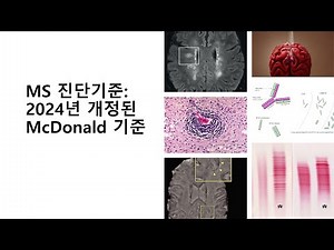 2024 개정된 다발성경화증 진단기준