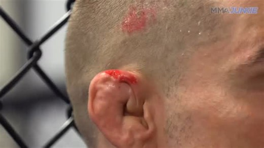 MMA Junkie | UFC stars tell the stories behind their first cauliflower ear 👂 | Instagram