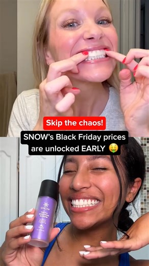 The wait is over — Early Black Friday is officially here! 🛍️✨ Get a head start on your holiday shopping and treat yourself to something special from SNOW. From sleek smile-care essentials to thoughtful gift ideas, it’s the perfect time to stock up before the rush begins 🎁 Enjoy limited-time offers, exclusive bundles, and free surprises added at checkout. 💫 Shop early, skip the stress — your favorites won’t last long! ⏰ | SNOW Teeth Whitening