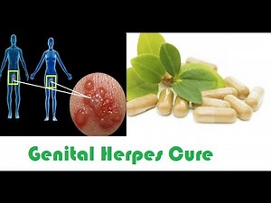 Latest Cure For Herpes : Home Remedies For Herpes
