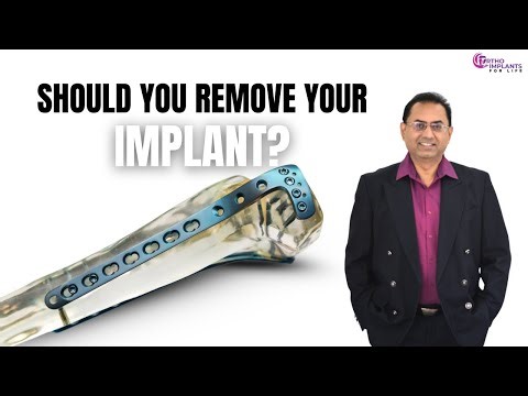 5 Reasons to Remove Orthopedic Implants — Is Removal Necessary