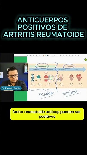 ⚠️ THIS IS HOW RHEUMATOID ARTHRITIS BEGINS
