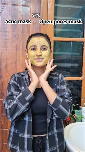 🌿Acne Mask VS 🍁Open Pores Mask #ytshorts #shiviskincare #shortsforgoals #trending #skincare