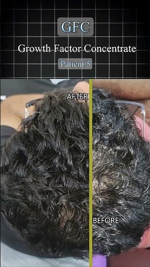[GFC] Before And After .. #gfc #hairtransformation #hair #beforandafter