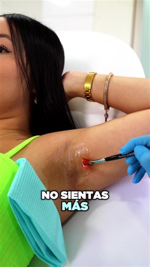 Peeling químico para aclarar manchas en invierno
