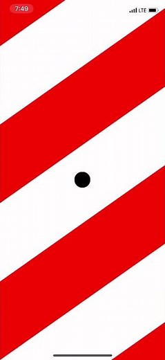 Vestibular Rehabilitation: Up Left Optokinetic (OPK) with Gaze Fixation