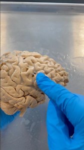 Controlling Your Impulses: Prefrontal Cortex!