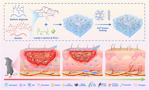 New Hydrogel-Based Treatment Accelerates Infected Wound Healing and Balances Skin Microbiota | Newswise