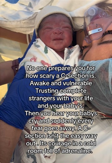 National C-section day ! Bringing awareness. Laid down in a surgery table consious while they cut 7 layers of my skin. That right there isn’t the “easy way out “ #csection #momsoftiktok #birthstory #csectionmom