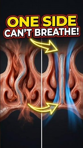 How Surgeons Fix a Deviated Septum Inside Your Nose 🤯 | 3D Animation #plasticsurgery #septum