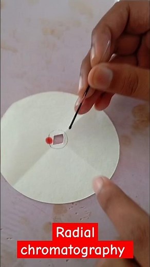 Radial chromatography