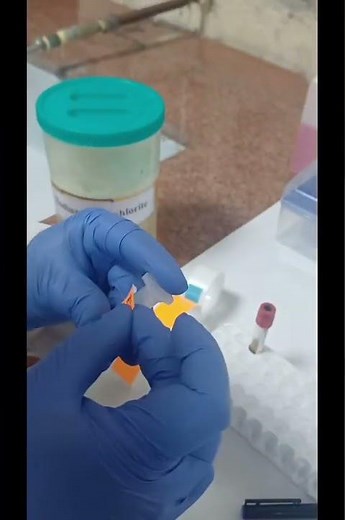 Serum Separation Using SST Tube |#Serum Separation#Centrifuge#LabVlog#ClinilLab#SSTTube#Biochemistry