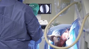 Chirurgiens de trauma pendant la chirurgie : vidéo de stock (100 % libre de droit) 3444955845 | Shutterstock