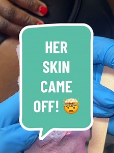 624K views · 10K reactions | Underarm wax with @MissCire 勺勺 Remember to exfoliate 2-3 times a week especially 48 hours before your wax appointment! This is going to help with ingrowns and treat dark areas. Also remember to stay hydrated! You can visibly see how dry her skin is and cracked near her pigmentation areas. #fyp #wax #esthetician #foryoupage #reelsfacebook #satisfying #underarmwax #EstheticianLife #exfoliating #skincare | Waxing Queen | Facebook