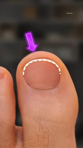 Why Cutting Your Toenails This Way Can Cause Problems💅