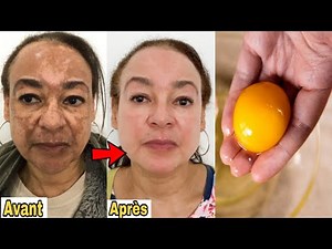 Traiter la pigmentation du visage, les taches brunes et le mélasma pour un visage plus lumineux