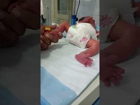 How to Pass an IV Line Step by Step | Nursing Procedure