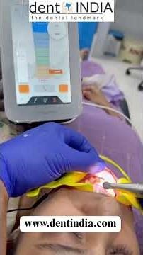 Dentsply x smart pro plus