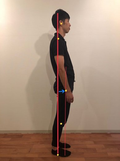 スウェイバック姿勢の原因と改善法｜猫背改善アカデミーby 猫背改善専門スタジオ「きゃっとばっく」