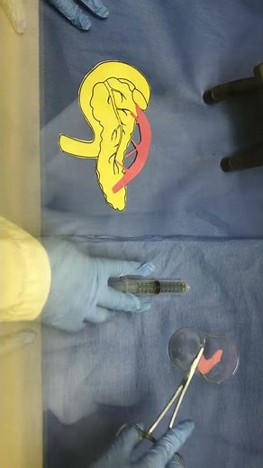 HOSA Medical Innovation Existing 2017-2018